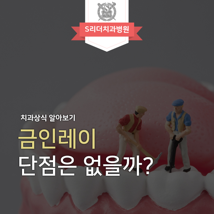 금인레이 단점 자세하게 알아봅시다! 관련 이미지 1