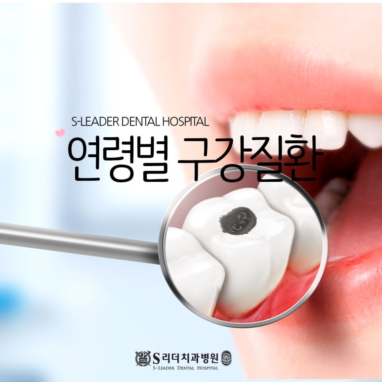 서울치과추천 연령별 받는 진료항목 살펴볼까요 관련 이미지 16