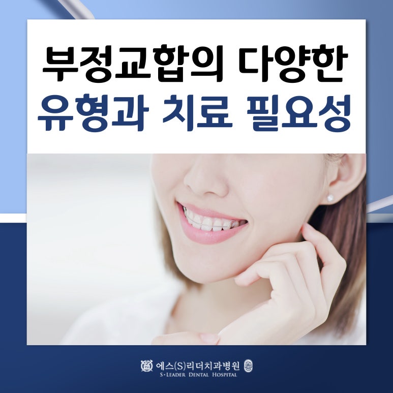 [건대치과] 치아교정, 나이에 따라 다르게 접근해야 하는 이유 관련 이미지 1