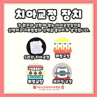 광진구치과, 치아교정 기간 왜 사람마다 다를까요? 관련 이미지 4