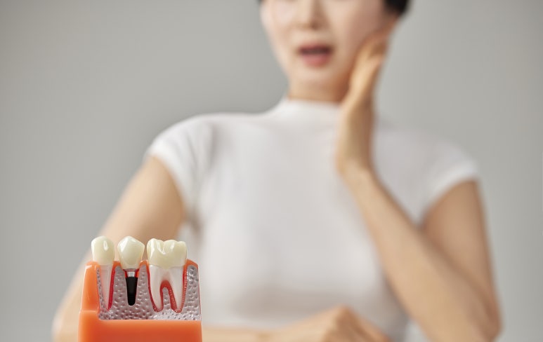 How Long Is the Recovery Period After Bone Grafting for Implants at Konkuk Univ. Station? image 7