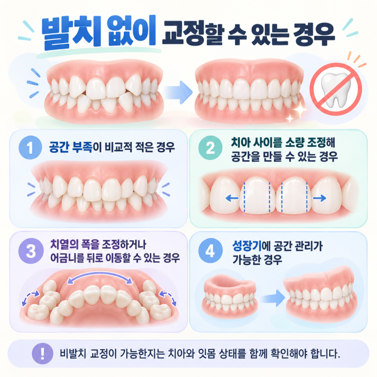 건대치아교정 덧니 교정, 발치가 필요한 경우와 그렇지 않은 경우 관련 이미지 4