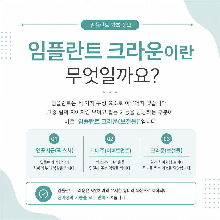 광진구임플란트 크라운은 얼마나 오래 사용할 수 있을까요? 관련 이미지 2