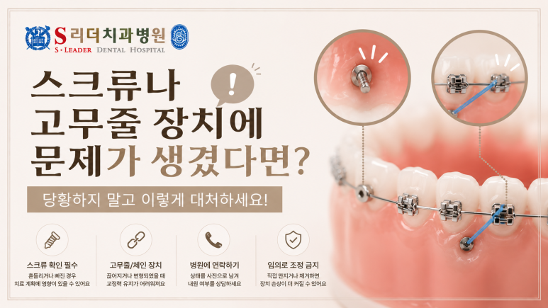 광진구치과|교정 장치가 떨어졌을 때 대처 방법, 그냥 두어도 괜찮을까요? 관련 이미지 5