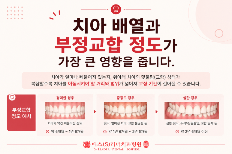 군자동치과 치아교정 기간은 왜 사람마다 다를까요? 관련 이미지 3