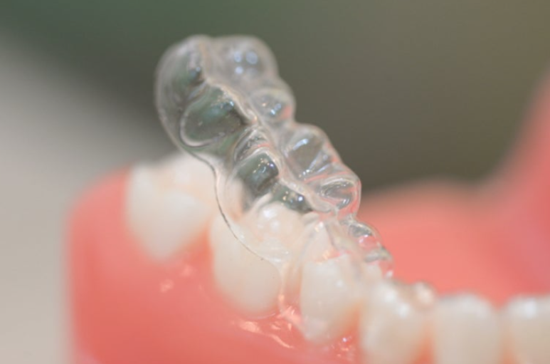 Konkuk University Orthodontic Clinic: Why Do Celebrities Prefer Clear Aligners for Orthodontic Treatment? image 6