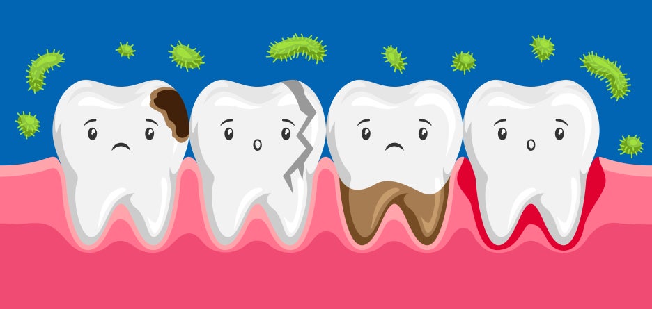 3 Important Things to Note About Chronic and Acute Periodontitis image 5