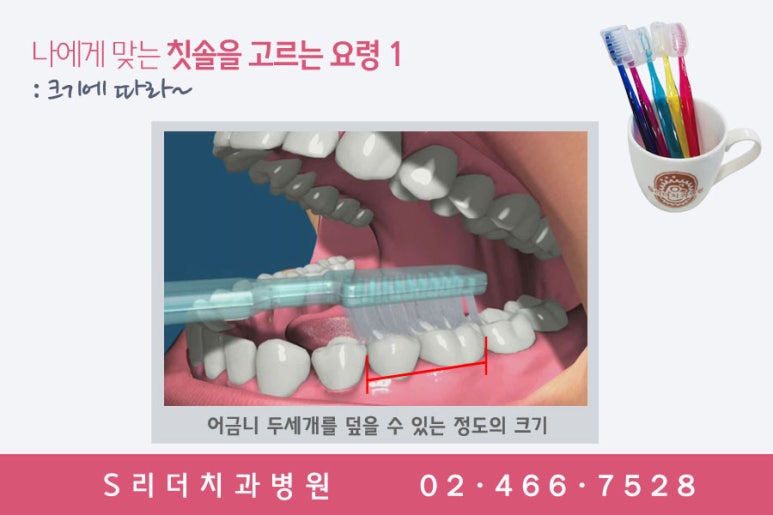 건대치과, 칫솔 정확히모르는 분이 더 많다. 관련 이미지 3