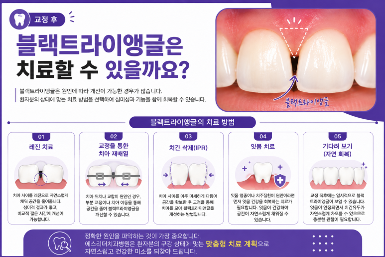 Konkuk University Orthodontics: Do Your Teeth Look Spaced Apart? It Could Be Caused by Black Triangles image 6