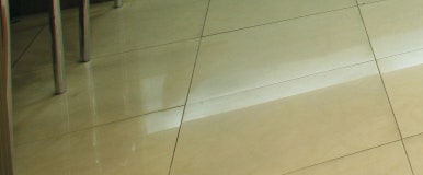 서울치과추천 오래된 보철 사용 중 이상증상 있다면 관련 이미지 19