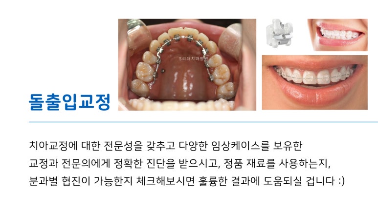 광진구교정치과, 돌출입 치아교정은 에스리더치과병원에서 시작하세요 관련 이미지 5