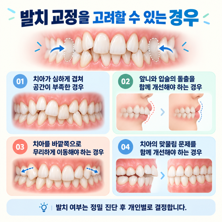 건대치아교정 덧니 교정, 발치가 필요한 경우와 그렇지 않은 경우 관련 이미지 3