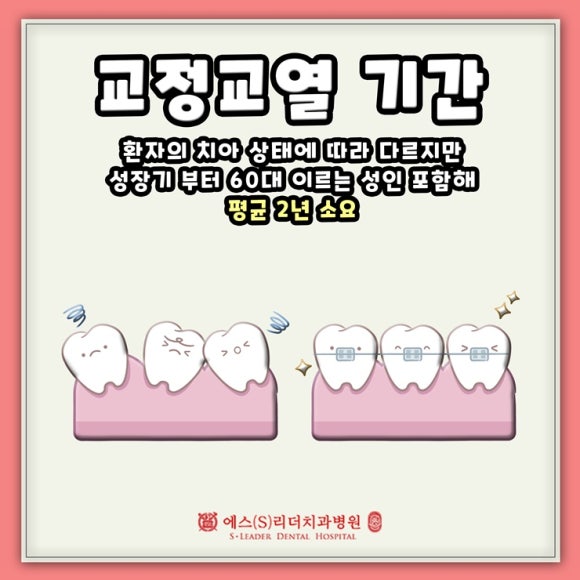 치아교정기간 성인발치 등 영향을 주는 것은 관련 이미지 2