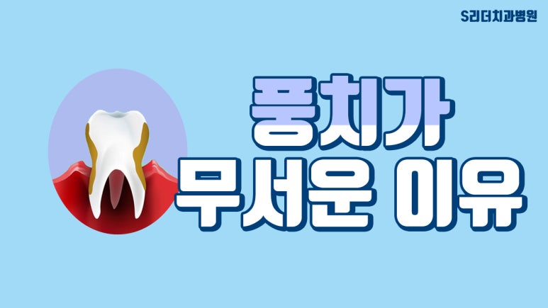 군자역치과, 풍치가 진행되면 나타나는 증상과 잇몸 치료방법 관련 이미지 2