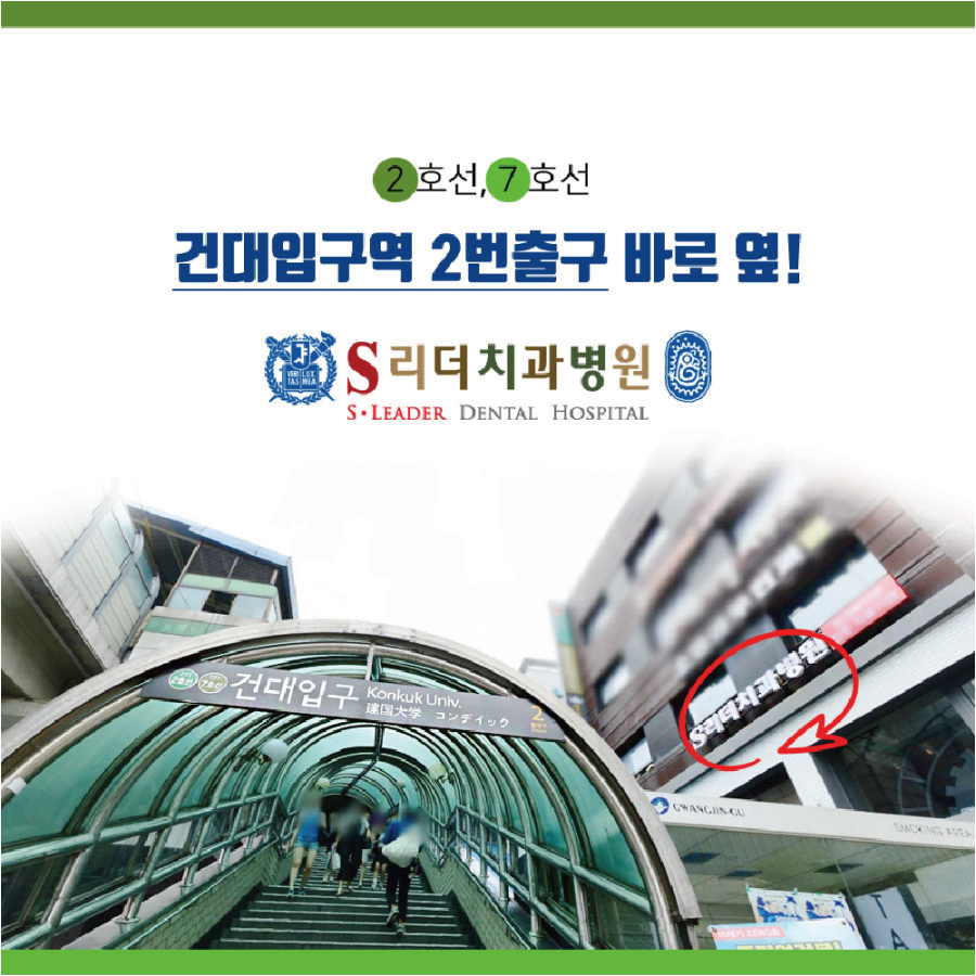 광진구임플란트 보철사용주의사항으로 오랜기간 사용하세요 관련 이미지 12