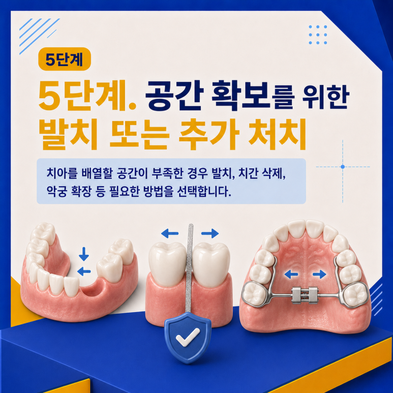 군자역치과 치아교정은 어떤 순서로 진행될까요? 단계별 과정 정리 관련 이미지 6