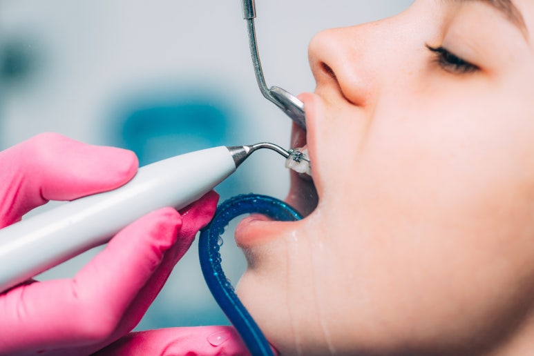 [Gwangjin-gu Dental Clinic] Home Care Dental Care for Preventing Cavities & Gum Inflammation image 4