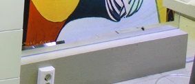 건대치과 주걱턱교정 부정교합3급치아교정 고려한다면 관련 이미지 19