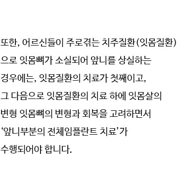 앞니임플란트 2개로 6개치아 완성 관련 이미지 6