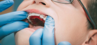Jayang-dong Dental Clinic: Why Are Retainers Absolutely Necessary After Orthodontic Treatment? image 3