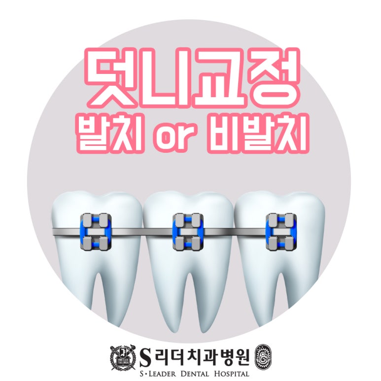 서울치아교정 덧니치아교정이 필요한 경우에 관련 이미지 1