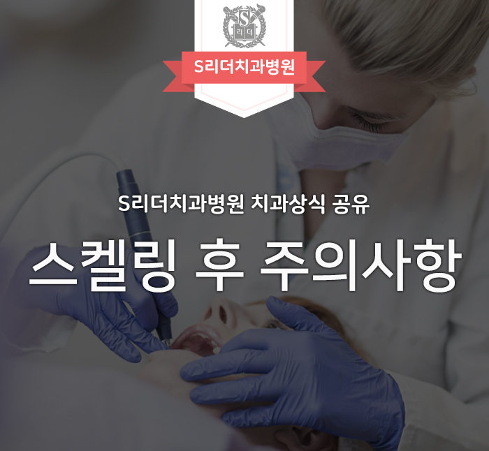 스켈링 후 주의사항, 스켈링에 대한 오해 알아보기 관련 이미지 1