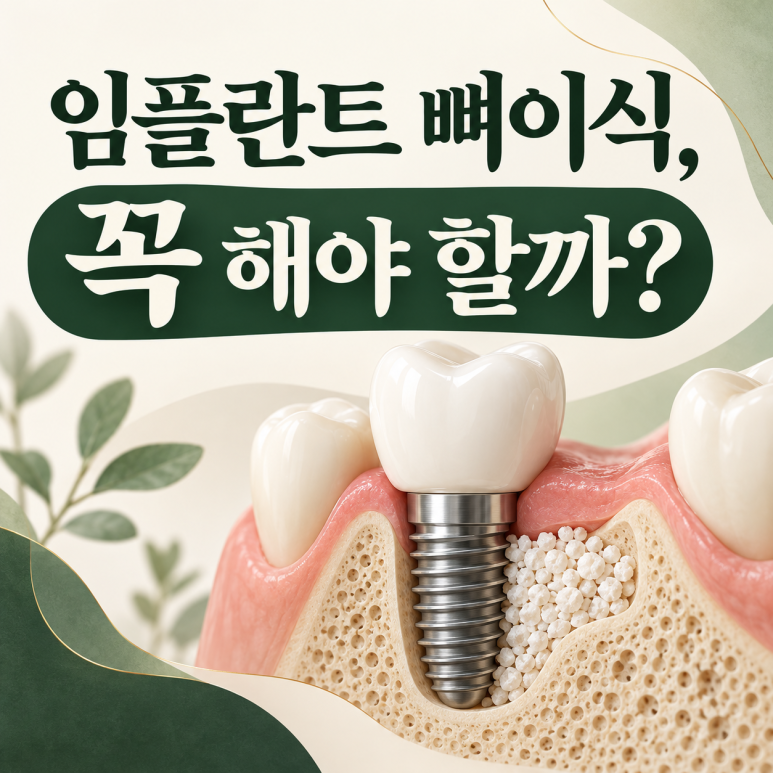 건대입구역치과 임플란트 뼈이식, 꼭 해야 하는 경우는? 관련 이미지 1
