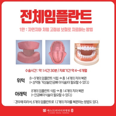 서울치과병원 초고령화사회일 수록 노인임플란트 혜택 받아보세요 관련 이미지 3
