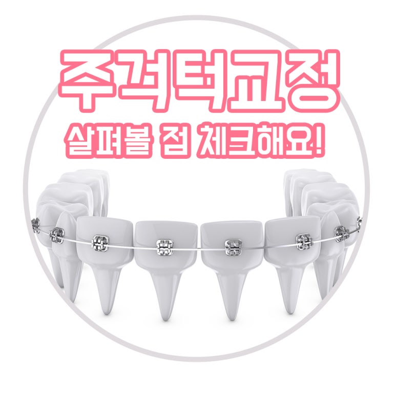 건대치과 주걱턱교정 부정교합3급치아교정 고려한다면 관련 이미지 1