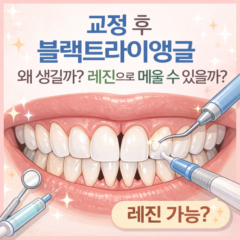 동대문구치과|교정 후 블랙트라이앵글, 왜 생길까? 레진으로 메울 수 있을까 관련 이미지 1