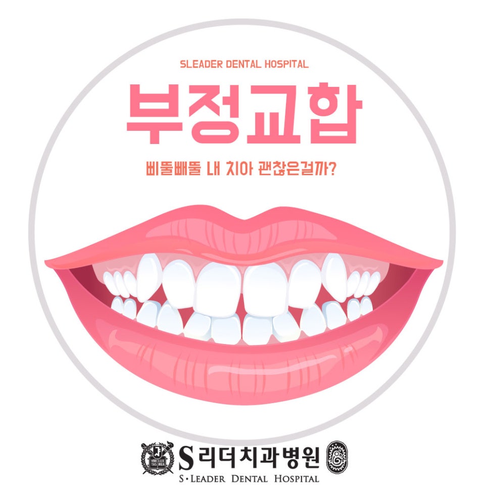 광진구치과추천 성인부정교합교정 1,2,3급 잘하는 곳에서 관련 이미지 4