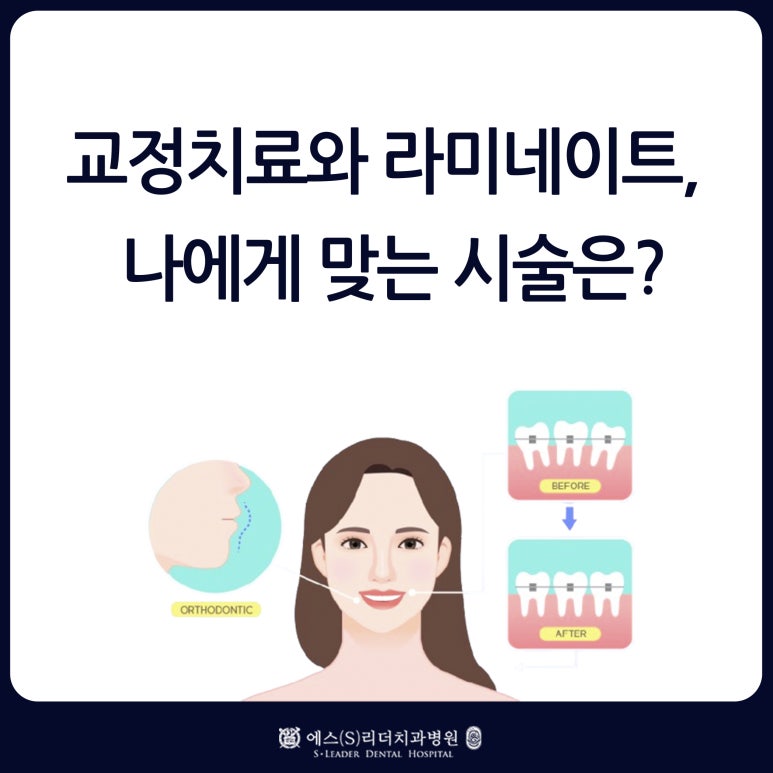 Seoul Yangsim Dental Clinic Laminate &middot; Orthodontic Treatment: Which Procedure Is Right for Me? image 1