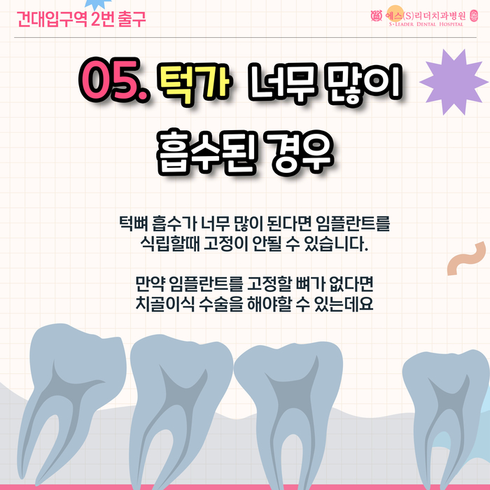 송정동치과 임플란트 안되는 사람들? 20대임플란트 가능한 시기 관련 이미지 7