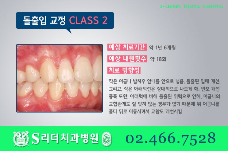 건대교정치과 똑같은 돌출입치아교정이 아니라는 점. 관련 이미지 6