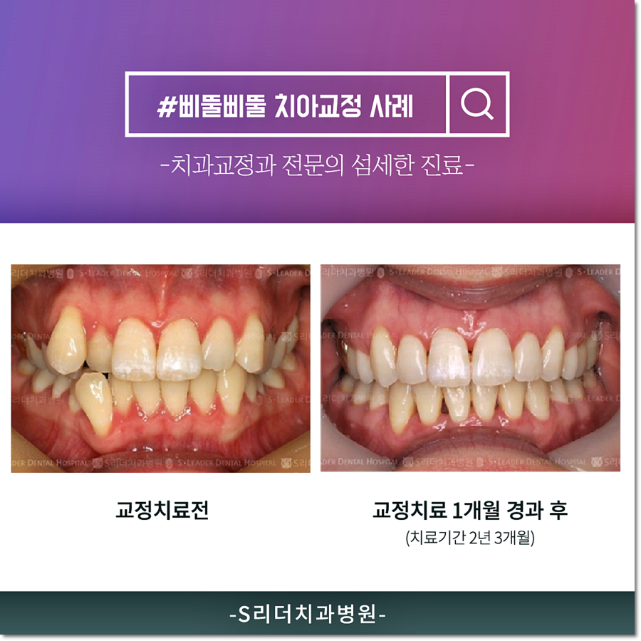 건대교정 치과, 과잉진료없는 투명한 건대치과 관련 이미지 3