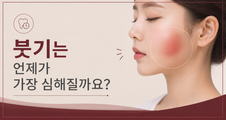 광진구임플란트|수술 후 붓기·멍 언제 빠질까? 회복 기간 총정리 관련 이미지 3