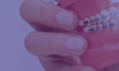 화양동치아교정 치과 고르는 방법에 대해서 관련 이미지 4