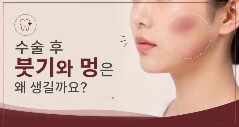 광진구임플란트|수술 후 붓기·멍 언제 빠질까? 회복 기간 총정리 관련 이미지 2