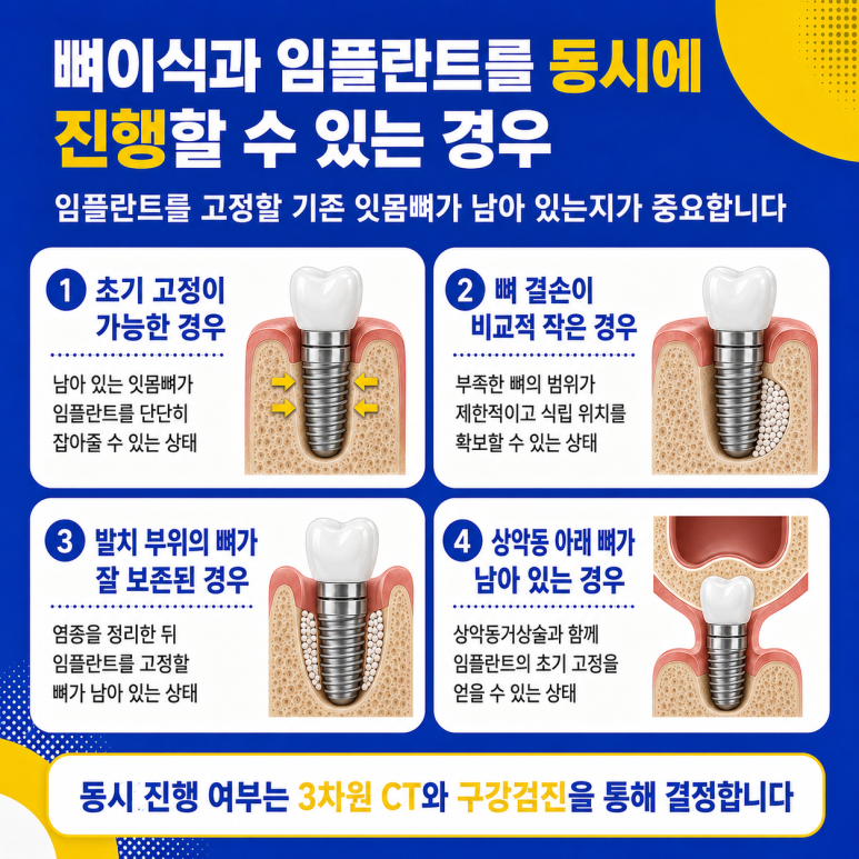 Hwanyang-dong Dental Clinic: Can Bone Grafting and Implant Placement Be Performed at the Same Time? image 4
