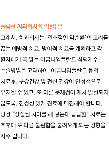 어금니임플란트 왜자꾸반복될까? 관련 이미지 10