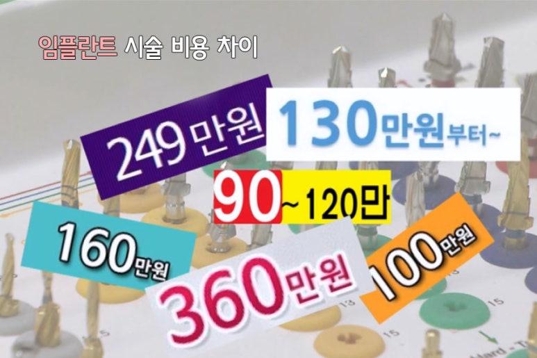 건대임플란트가 궁금해~ 관련 이미지 6