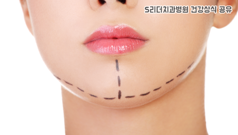 예뻐지는 방법 성형만이 정답이 아닌 이유 관련 이미지 3