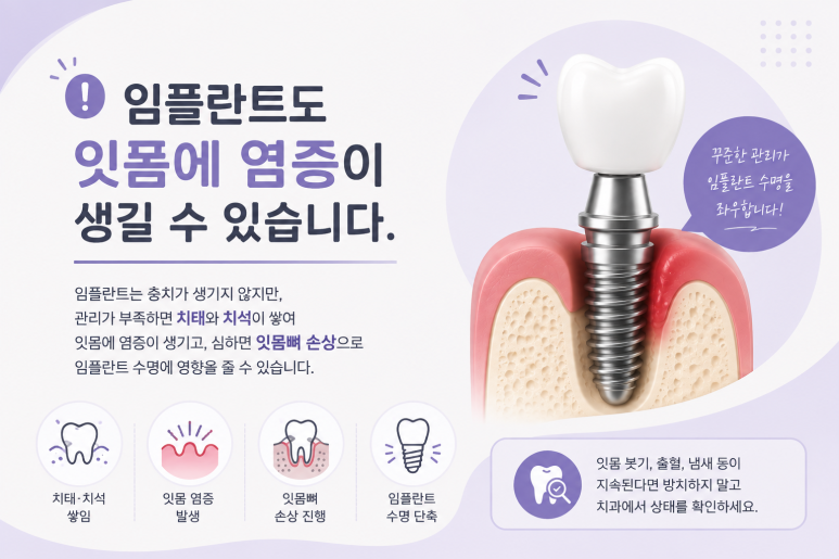 Gwangjin-gu Dental Implants: How to Care for Them for Long-Term Use image 3
