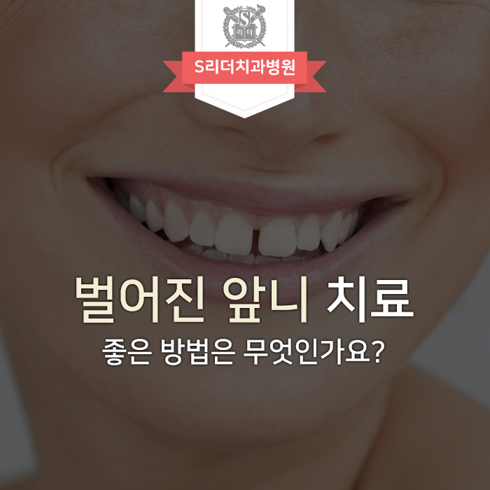 벌어진 앞니치료에 대한 솔직한 이야기 관련 이미지 1