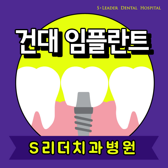 건대임플란트 치료양은 적게 하면서 효과는 높게 도출... 관련 이미지 1