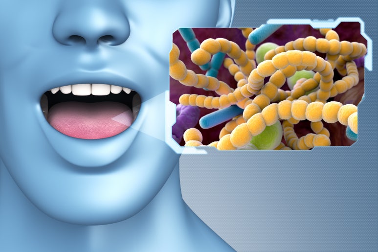 5 Dental Causes of Halitosis (Bad Breath) Explained by Sagajeong Station Dental Clinic image 6
