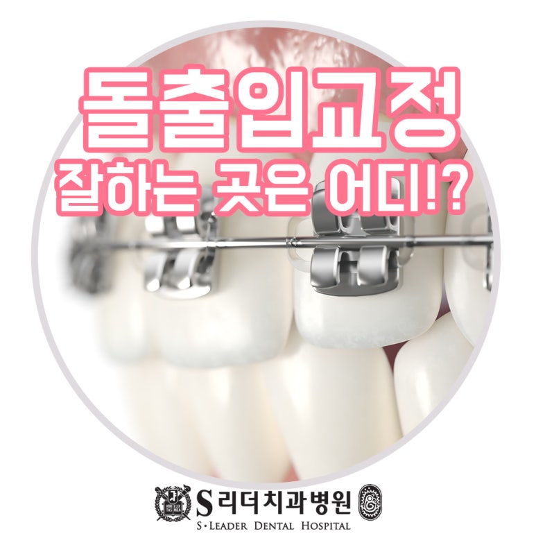 군자역치과 돌출입교정 또는 돌출입수술을 고민이라면 관련 이미지 1