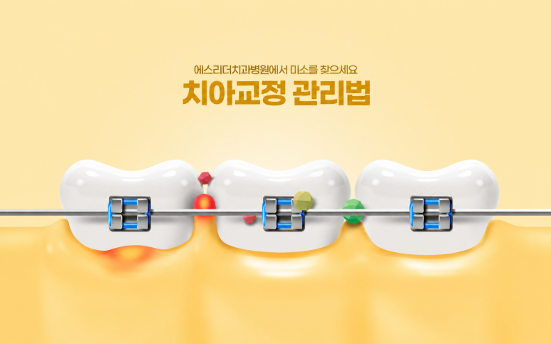 Gwangjin-gu Orthodontic Clinic: Why Do Orthodontic Treatment Periods Differ? Checkpoints That Determine Treatment Speed image 5