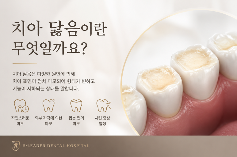 건대입구치과|치아 닳음, 방치해도 될까? 증상과 원인은? 궁금하다면 클릭! 관련 이미지 2