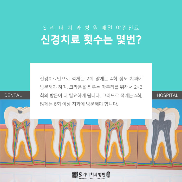 건대 신경치료 횟수 몇번 필요할까요? 관련 이미지 2